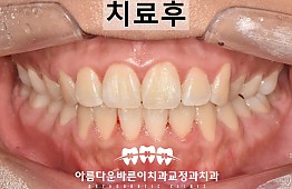 수술후