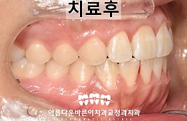 수술후