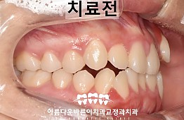 수술전