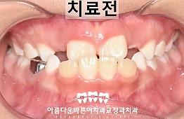 수술전