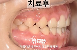 수술후