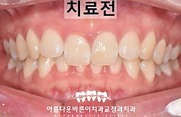 수술전