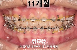 수술후