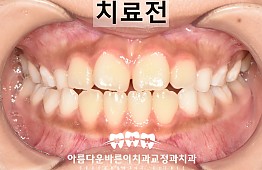 수술전