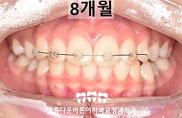 수술후