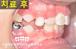 수술후