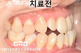 수술전