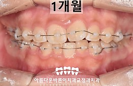 수술후