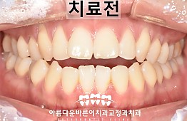 수술전