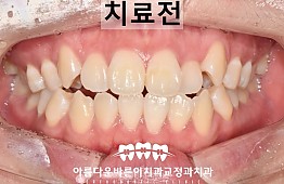 수술전