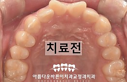 수술전