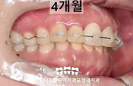 수술후