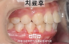 수술후