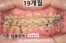 수술후