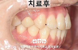 수술후