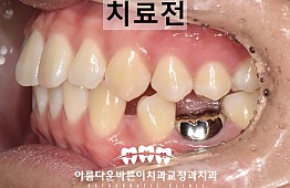 수술전