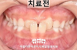 수술전