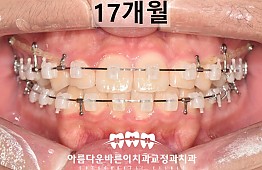 수술후