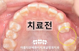 수술전