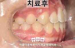 수술후