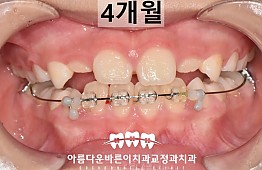 수술후