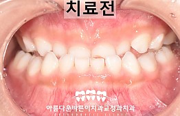 수술전