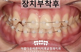 수술후