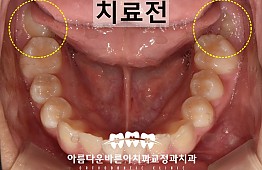 수술전