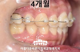 수술후