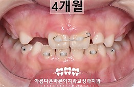 수술후