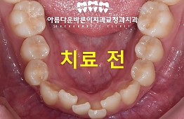 수술전