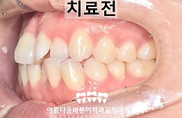 수술전