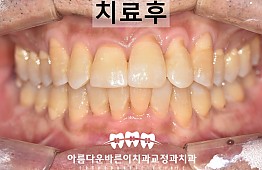 수술후