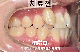 수술전