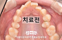 수술전