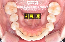 수술후