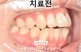 수술전