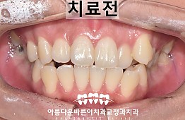 수술전