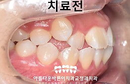 수술전