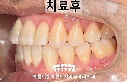 수술후