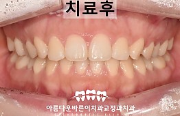 수술후