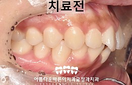 수술전