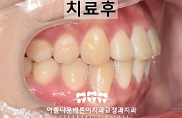 수술후