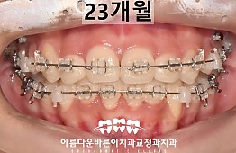 수술후