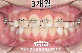 수술후