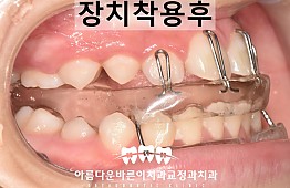 수술후