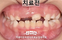 수술전