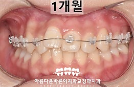 수술후