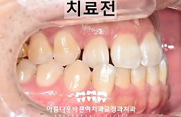 수술전