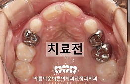 수술전